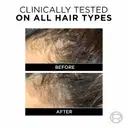 L'Oreal Paris Fall Repair 3X Anti Hair Fall Shampoo  – image 3